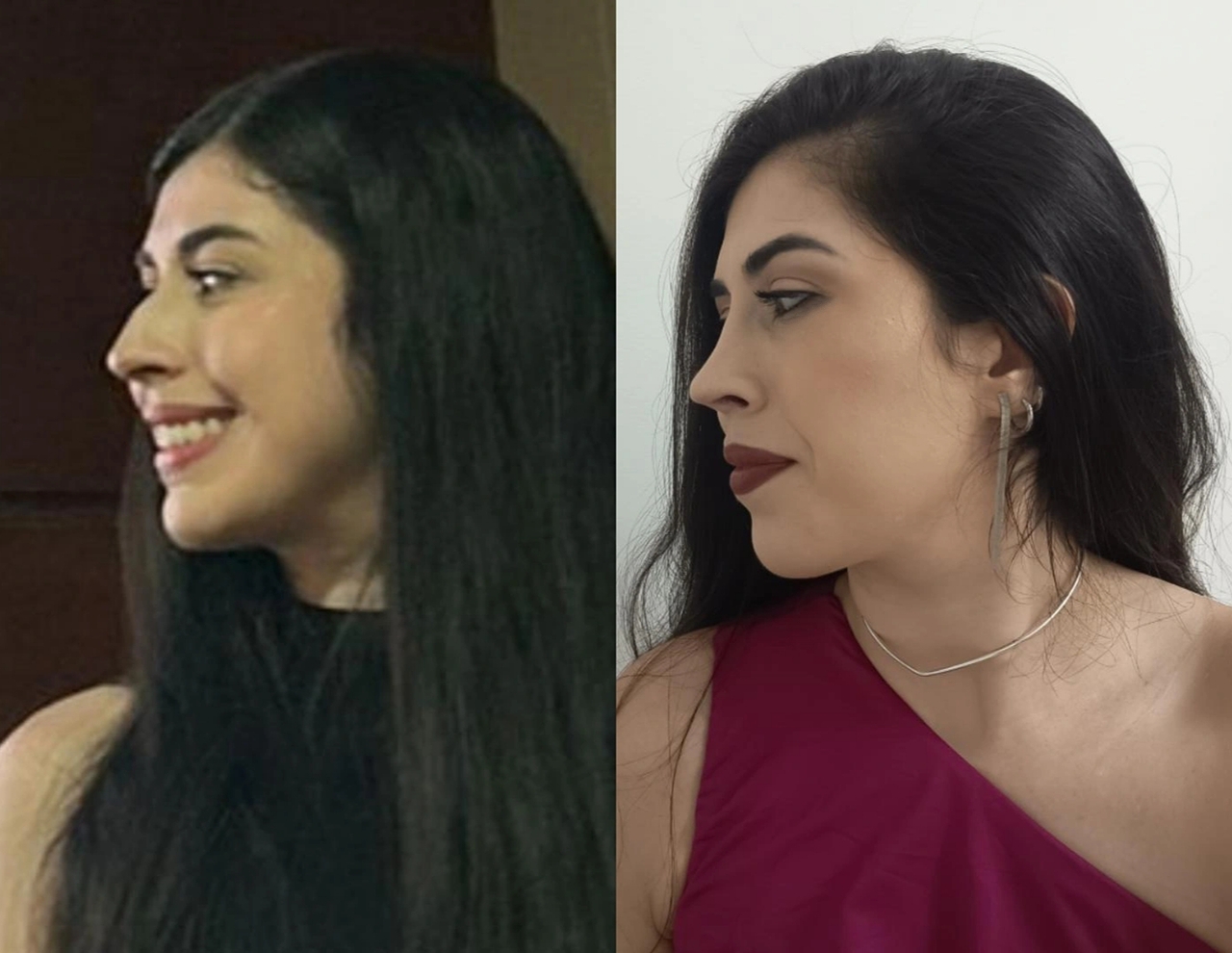 Cirurgião especialista em rinoplastia e cirurgias da face